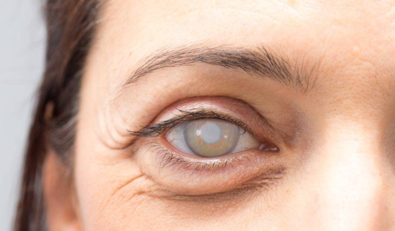 Tavuk Karası Hastalığı Tedavisi